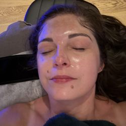 MOD Facial - Post facial serenity