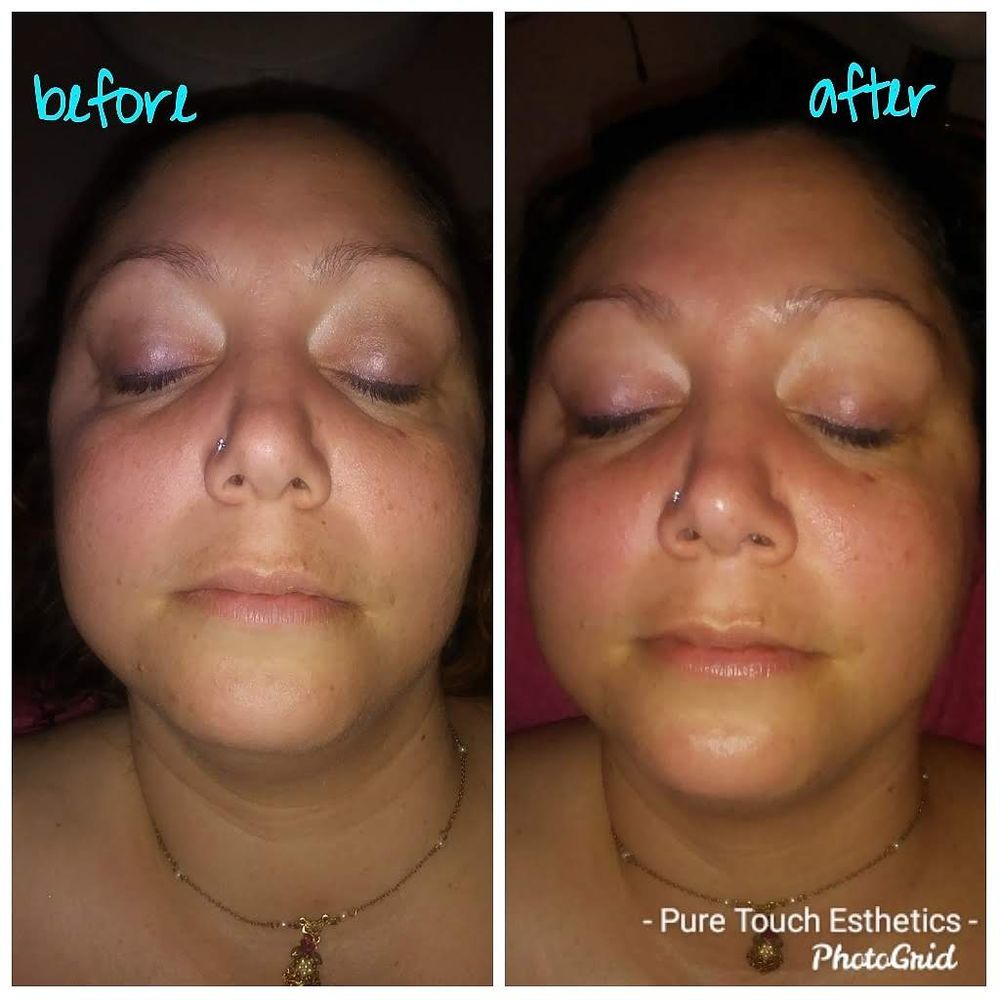 Pure Touch Esthetics Logo