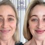 Beverly Wilshire Aesthetics