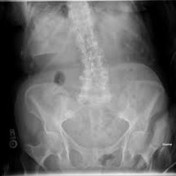 Aloha Family Chiropractic - We can take your X-rays right here in our office.