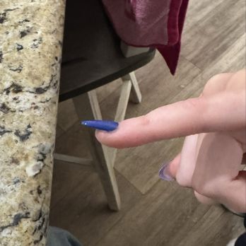 London Nail Bar - Completely crooked and lifted nail - Waxing Near Me - Jurupa Valley, California London Nail Bar - Completely crooked and lifted nail - Waxing Near Me - Jurupa Valley, California