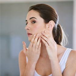Natural Look Medical Spa - Acne Awareness Month. Safe, simple, effective and affordable treatments and products to clear acne at Natural Look Medical Spa.