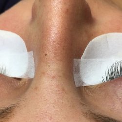 Noralash - Before and after
