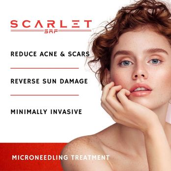 On The Fly Aesthetics - Scarlet treatments. No downtime. Minimal discomfort. Great for minimizing scars and acne. - Weight Loss Centers Near Me - Collierville, Tennessee On The Fly Aesthetics - Scarlet treatments. No downtime. Minimal discomfort. Great for minimizing scars and acne. - Weight Loss Centers Near Me - Collierville, Tennessee