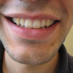 Saba Lakhani, DDS - Bethesda-Chevy Chase Smiles