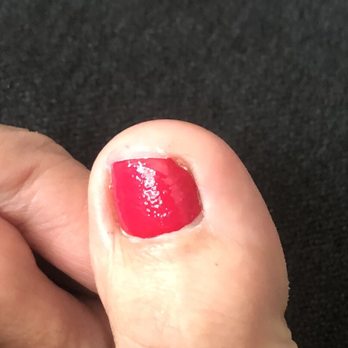 Anthony Vince' Nail Spa - Sorry for the close up of a toe but wanted to show the texture of the polish. Little bubbles on the surface. - Nail Salons Near Me - Carmel, Indiana Anthony Vince' Nail Spa - Sorry for the close up of a toe but wanted to show the texture of the polish. Little bubbles on the surface. - Nail Salons Near Me - Carmel, Indiana
