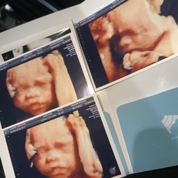 28 weeks 28 weeks