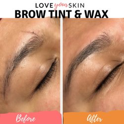 Love Your Skin - This lovely lady was looking for a natural look, and they turned out great! Two weeks with zero maintenance or makeup.
