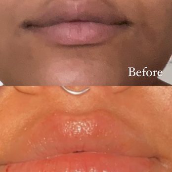 Skinlastiq - Skin Care Near Me - Burlingame, California