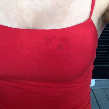 Bulldog Laundry and Dry Cleaning - stains like this all the way down the dress. small holes at top too. - Laundromat Near Me - Athens, Georgia Bulldog Laundry and Dry Cleaning - stains like this all the way down the dress. small holes at top too. - Laundromat Near Me - Athens, Georgia