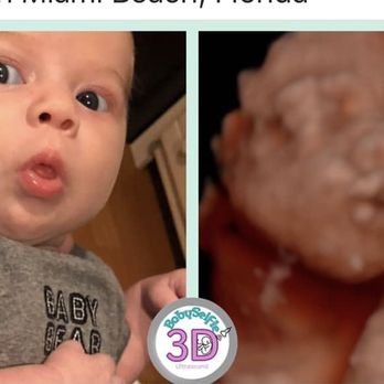 Baby Selfie 3D - Ultrasound Imaging Centers Near Me - Pembroke Pines, Florida Baby Selfie 3D - Ultrasound Imaging Centers Near Me - Pembroke Pines, Florida