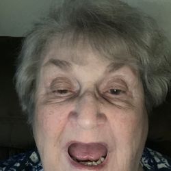 Derry Dental Associates - I tried to show the absence of.top teeth but I couldn't lift my lip and take the picture at the same time.