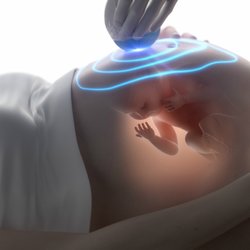 Ultra Imaging