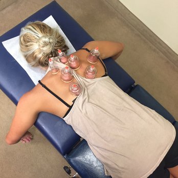 CleanSpine - Cupping treatment - Chiropractors Near Me - Irvine, California