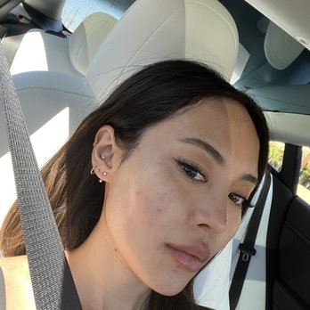 The Image Center - Right after my procedure with minimal swelling!! - Plastic Surgeons Near Me - Irvine, California The Image Center - Right after my procedure with minimal swelling!! - Plastic Surgeons Near Me - Irvine, California