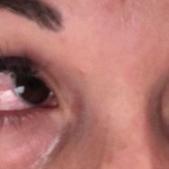 Johnny's Lashes - BACTERIAL conjunctivitis (pink eye) - Eyelash Service Near Me - San Bernardino, California Johnny's Lashes - BACTERIAL conjunctivitis (pink eye) - Eyelash Service Near Me - San Bernardino, California