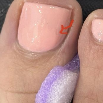 Luxury Nails & Spa - He scratched my toe nail with his nail while cleaning and instead to re-do my toe nail. He put another coat and that was the result. - Nail Salons Near Me - Naples, Florida Luxury Nails & Spa - He scratched my toe nail with his nail while cleaning and instead to re-do my toe nail. He put another coat and that was the result. - Nail Salons Near Me - Naples, Florida