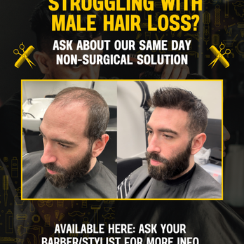 Peter - hair replacement service - Hair Stylists Near Me - Plantation, Florida Peter - hair replacement service - Hair Stylists Near Me - Plantation, Florida