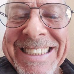 Star Dental - My amazing smile transformation
