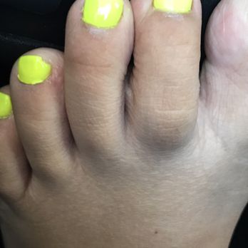 True Nails - next to pinky toe. - Nail Salons Near Me - Glendale, Arizona
