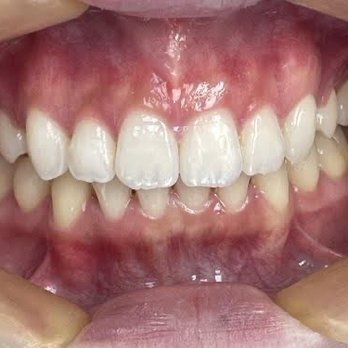 Paul P Chon, DDS - Cosmetic Invisalign treatment - General Dentistry Near Me - Irvine , California