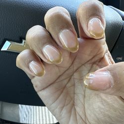 Q Nails & Spa - You can see the lumps in my nails , how they're not even cantered the correct way they looked deformed