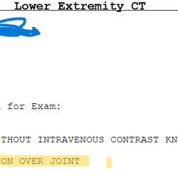 Harbor Regional Health Community Hospital - Wrong knee