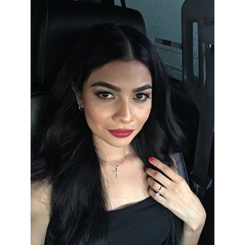 Plush Derma - Wrinkle free ;) Botox by Dr. Ghazi for my crows feet - Laser Hair Removal Near Me - El Monte, California Plush Derma - Wrinkle free ;) Botox by Dr. Ghazi for my crows feet - Laser Hair Removal Near Me - El Monte, California
