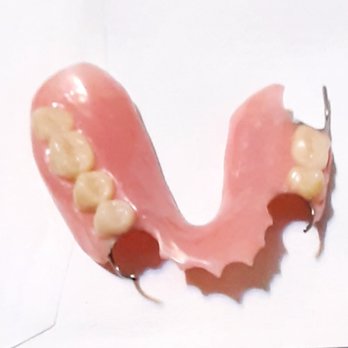 Dr. Jesús Manuel García Rodríguez - My temporary partial dental plate. - General Dentistry Near Me - Tijuana, BCN Dr. Jesús Manuel García Rodríguez - My temporary partial dental plate. - General Dentistry Near Me - Tijuana, BCN