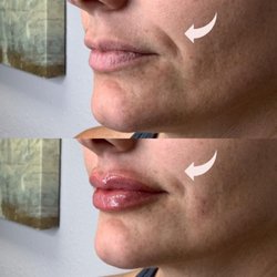 Flawless Med Spa