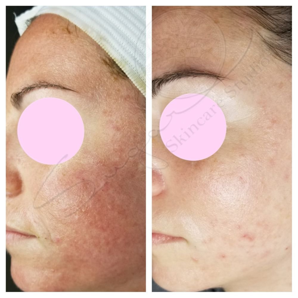 SUGAR SKINCARE STUDIO 131 Photos & 23 Reviews 1210 NE 4th Ave, Fort