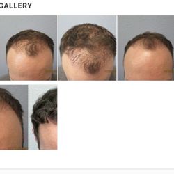 Nalini, MD - Before and after