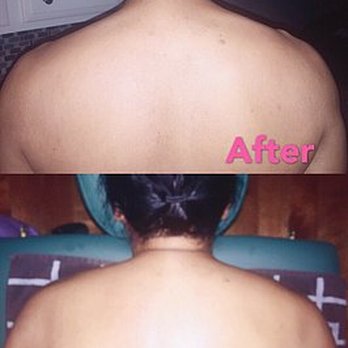 Long Spa - Myofascial tautness, tight upper Trapezius - Massage Therapy Near Me - Mesquite, Texas Long Spa - Myofascial tautness, tight upper Trapezius - Massage Therapy Near Me - Mesquite, Texas