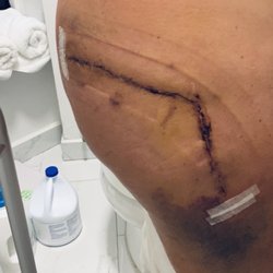 Seaview Orthopaedic & Medical Associates - This was the end result from HSS fixing Cozzarellis work