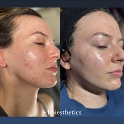 BBI Esthetics