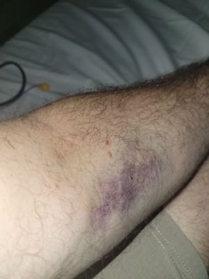 TriStar Skyline Medical Center by null