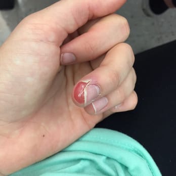 Pro Nails - Infection from being cut by the tools - Nail Salons Near Me - Reno, Nevada