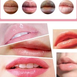 La Biotique - Gold Collagen Lip Mask