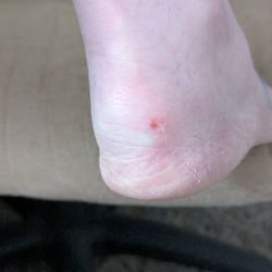 Angel Nails & Spa - Scraped heal way too high instead of lower foot.
