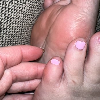 Filed Nails Spa & Beauty - Gel polish all over my skin around my toes.. gel polish already snagging and peeling off - Nail Salons Near Me - Norman, Oklahoma Filed Nails Spa & Beauty - Gel polish all over my skin around my toes.. gel polish already snagging and peeling off - Nail Salons Near Me - Norman, Oklahoma
