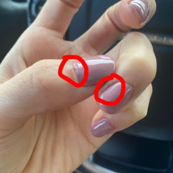 Bella Nails Lounge - Cuts from cuticle remover - Nail Salons Near Me - Torrance, California Bella Nails Lounge - Cuts from cuticle remover - Nail Salons Near Me - Torrance, California