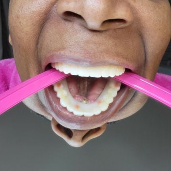 Ora Dentistry - Viewing already infected gum tissue. - Cosmetic Dentists Near Me - Elk Grove, California Ora Dentistry - Viewing already infected gum tissue. - Cosmetic Dentists Near Me - Elk Grove, California