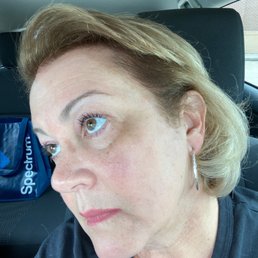 Notice hair color stain in front of hairline.