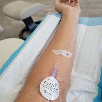 ASAP IVs - IV Hydration Near Me - La Jolla, California