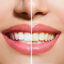 Broadway Dental Clinic - Broadway Dental Clinic
