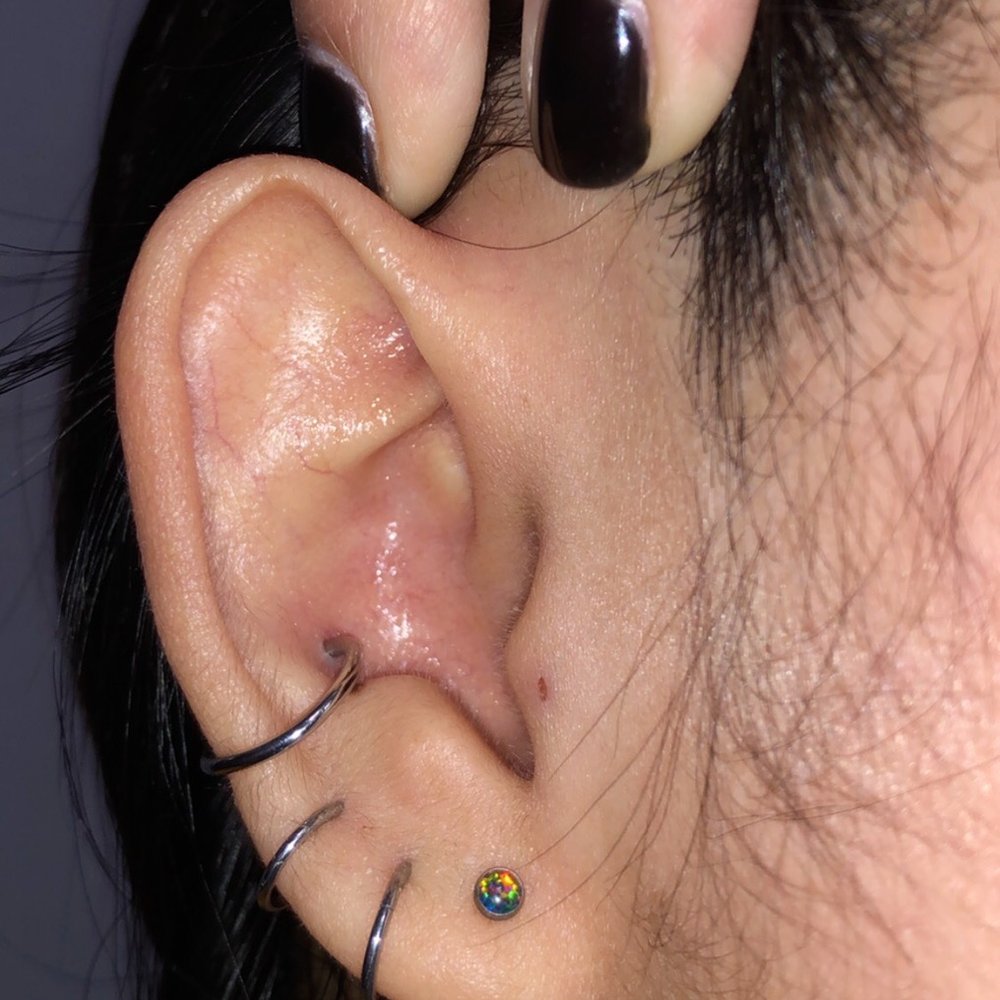 Mystical Illusions - after removal - Piercing Near Me - Oklahoma City, Oklahoma Mystical Illusions - after removal - Piercing Near Me - Oklahoma City, Oklahoma