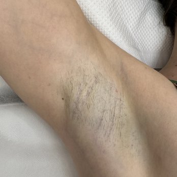 Skin Bar & More - Armpits waxing - Estheticians Near Me - Rocklin , California