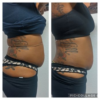 Body Nirvana - Body Contouring Near Me - Sacramento, California Body Nirvana - Body Contouring Near Me - Sacramento, California