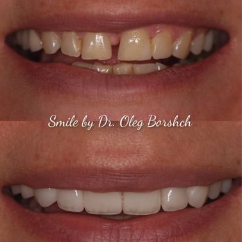 Oleg Borshch, DDS - Cosmetic Dentists Near Me - New York, New York Oleg Borshch, DDS - Cosmetic Dentists Near Me - New York, New York