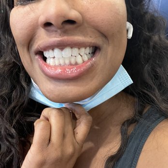 Crystal Bright Smile - Cosmetic Dentists Near Me - Tujunga, California
